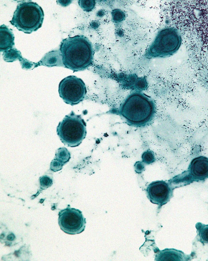 Les probiotiques végétaux sont-ils plus efficaces que les probiotiques laitiers ?