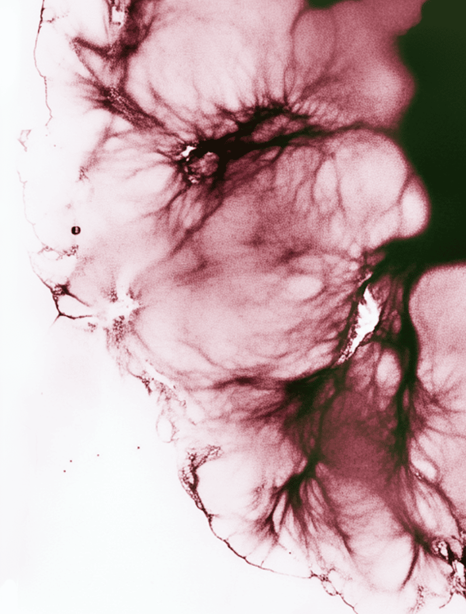 L'importance du microbiote intestinal