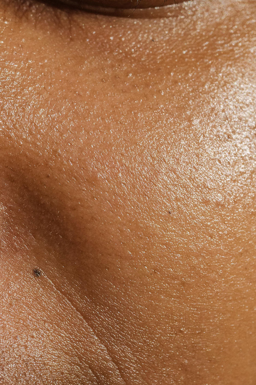 Acné, eczéma, teint terne : et si c’était votre microbiote ?