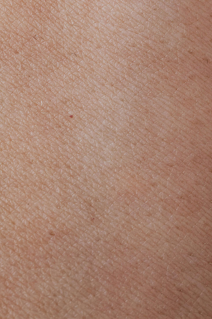 Acné, eczéma, teint terne : et si c’était votre microbiote ?